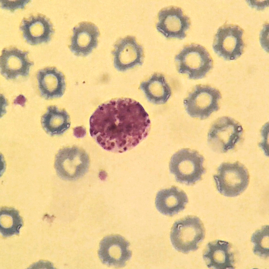 Basophil granulocyte in May-Grunwald-Giemsa stained blood smear; note the dark purple-black granules filling the cytoplasm.