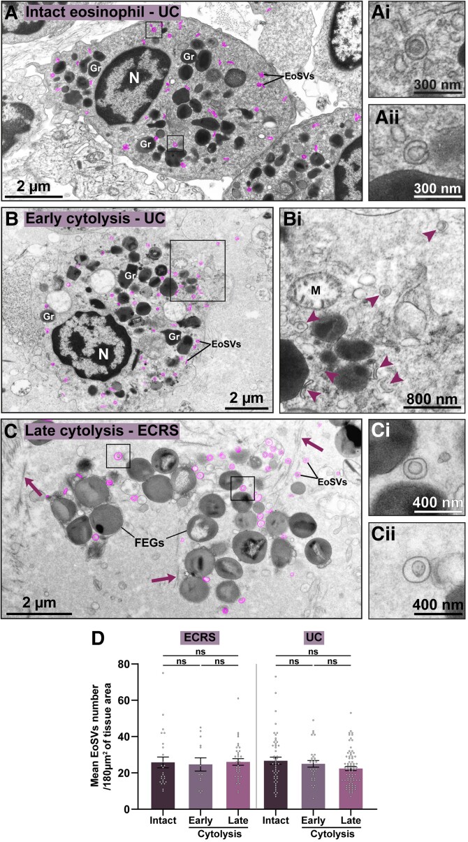 Transmission electron micrograph of a human eosinophil showing granules with their characteristic crystalloid core (major basic protein) surrounded by a less-dense matrix.