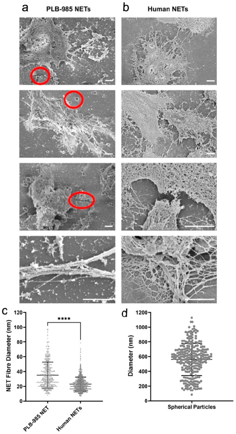 Structural analysis of differentiated PLB-985 and human neutrophil NETs. SEM images of PLB-985 NETs ( a ) and human NETs ( b ). Scale bars are 2 um. Red circle: spherical particles, either individually or in a series (n >= 3). SEM analysis of NET fibre diameter (( c ), n >= 514) and the diameter of spherical particles in PLB samples (( d ), n = 261). Error bars represent mean +/-SD. **** p < 0.0001. ( c ) The statistical analysis results were obtained using the non-parametric Mann-Whitney test. Experiments were performed independently at least three times using separate cell preparations.