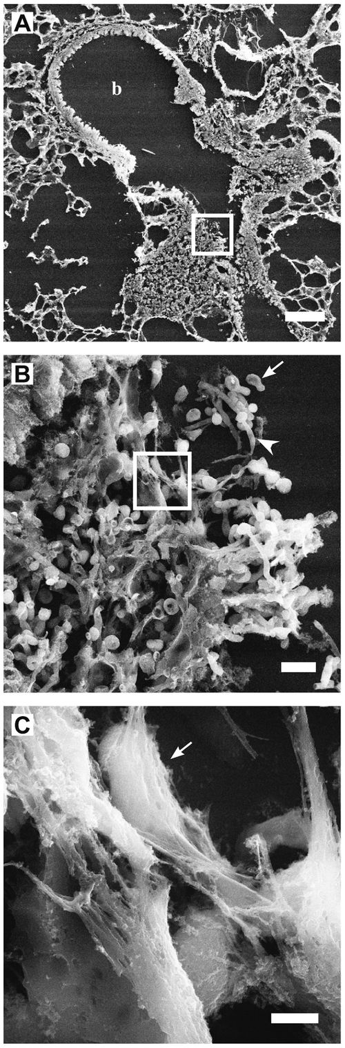 Scanning electron micrograph of neutrophil extracellular traps (NETs): fine fibres of decondensed chromatin with embedded granule proteins enmeshing Staphylococcus aureus.