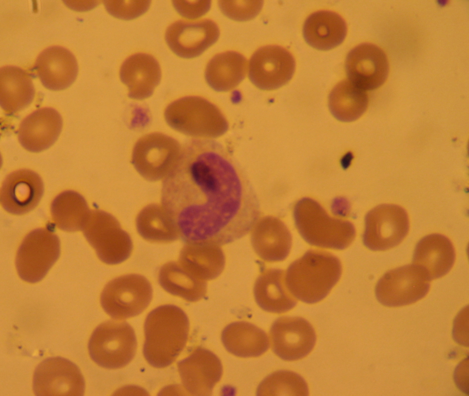 Band neutrophil (immature neutrophil with unsegmented nucleus) in a peripheral blood smear at 40x magnification.