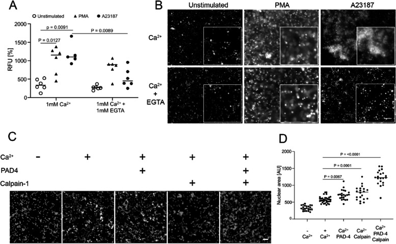Ca2+ Influx activates PAD-4 and calpain-1 and promote neutrophil extracellular trap (NET) formation. A shows chromatin externalization from healthy neutrophils (n > 5) treated with PBS unstimulated, 100 ng/ml phorbol 12-myristate 13-acetate (PMA), or 10 μM calcium ionophore A23187 in the presence and the absence of calcium chelator EGTA. Data were analyzed using Tukey's multiple comparisons tests. Note, the calcium-driven NET formation was abrogated by EGTA. B Microscopic analyses of SYTOX Green stained DNA from neutrophils and NETs at 4 h after stimulation. C Microscopic examination of the swelling of isolated nuclei from neutrophils in the presence and/or absence of PAD4, calpain and calcium. D Morphometry of the nuclear sizes from (C). Note that calcium, PAD4, and calpain-1 act synergistically in decondensation/swelling of nuclei. Tukey's multiple comparisons test was used to evaluate the differences among means. The scale bars are 100 and 50 μm in (B) and (C), respectively.